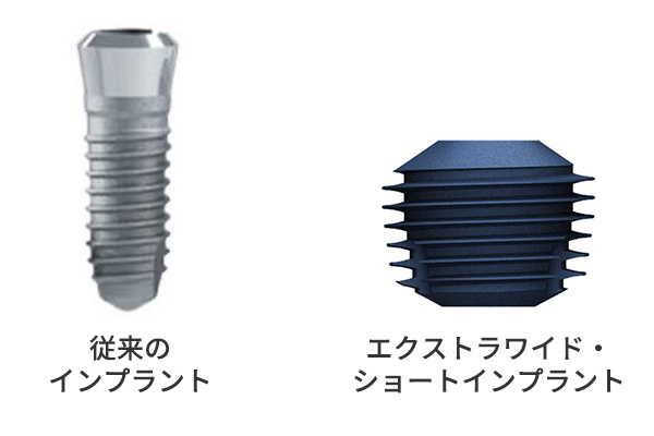 エクストラワイド・ショートインプラント、従来のインプラントとの比較