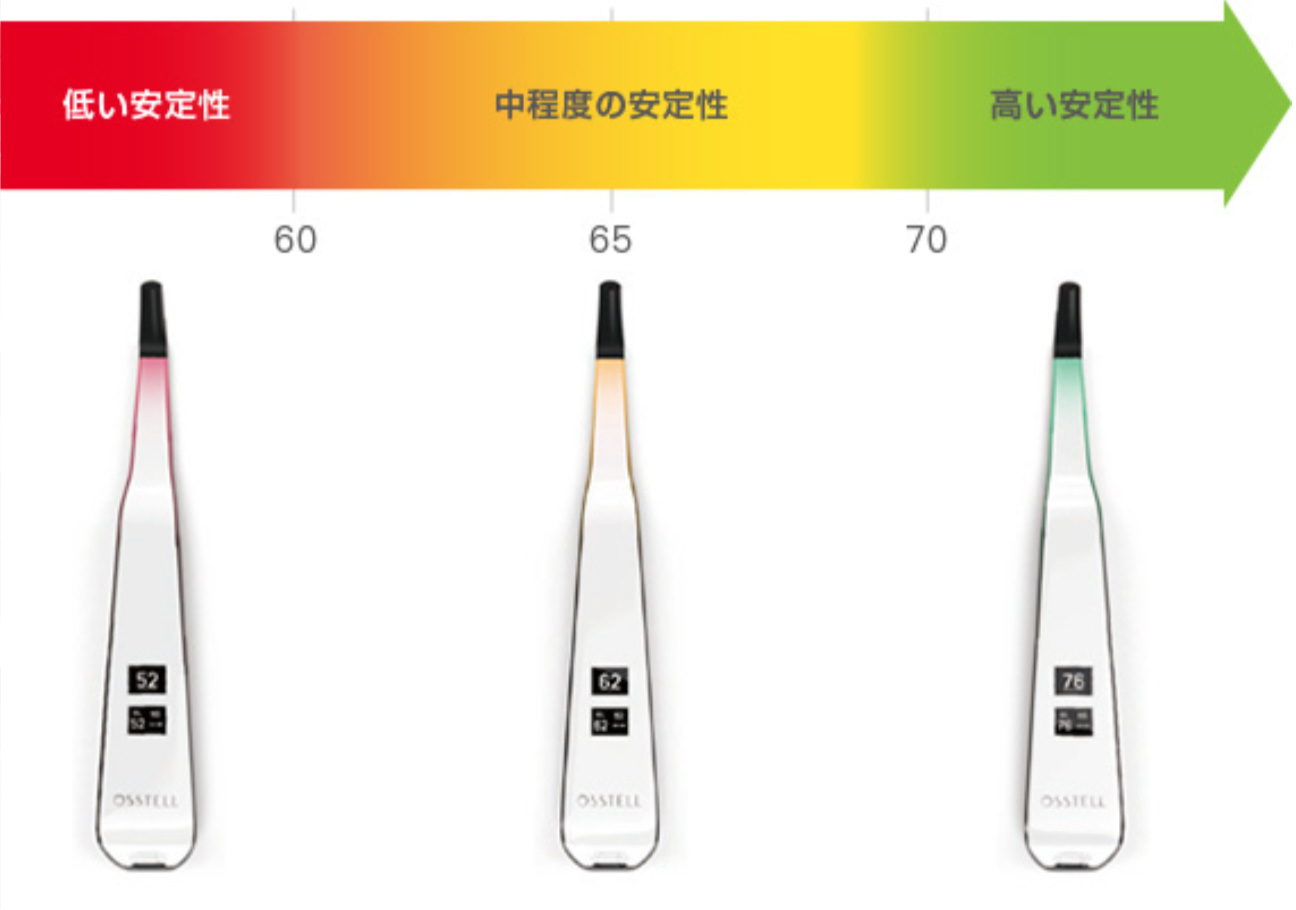 オステルビーコン数値